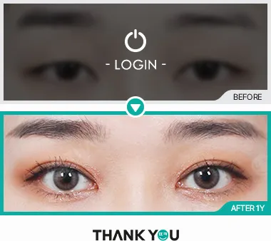 Before/After