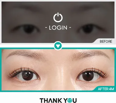 Before/After