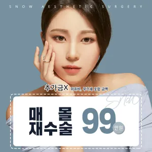 비밀눈성형 매몰재수술