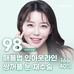 눈재수술 쌍꺼풀 매몰, 인아웃라인으로 자연스럽게