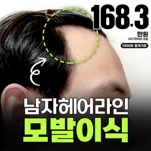 아이돌 헤어라인 모발이식