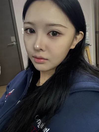 코재수술하니까 셀카 찍을맛나요 :)