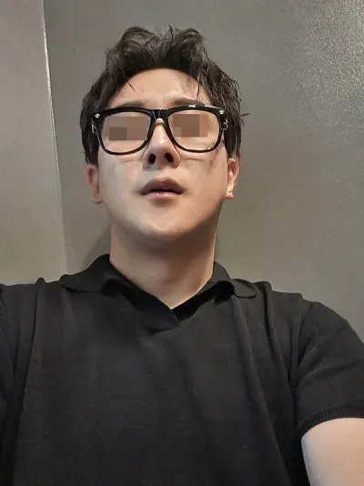 남자 / 코 안면윤곽 이중턱근육묶기 동시에 받았습니다.