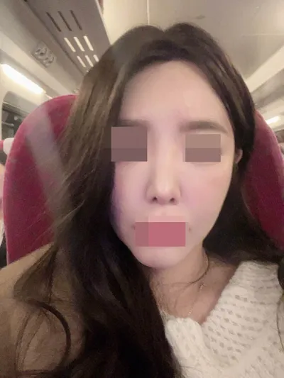 코재수술 받고 자신감도 상승했어요 :)