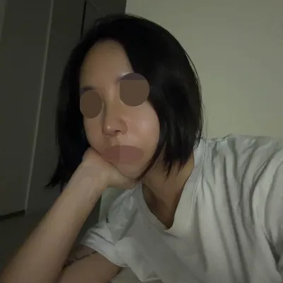 원트 김현우원장님한테 코재수술 (자가늑) 받은 후기