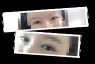 재수술이더랬지요,,,