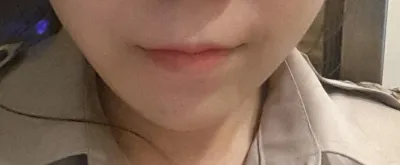 원장쌤 잘지내시죠? 저 사가턱 수술했던 은정이에요.