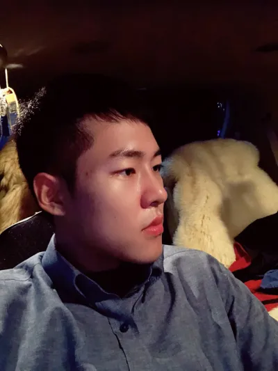 남자코 수술 후기