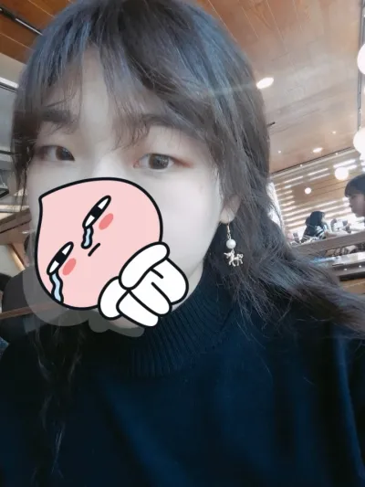 절개눈매교정+트임수술 굿!!!