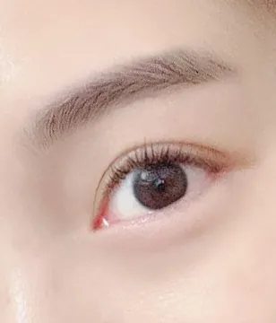 절개눈 눈매교정!!