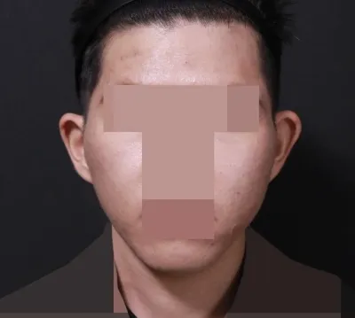 얼굴형이 달라지는게 보여요