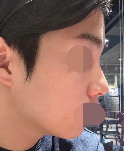 지금 3개월 정도 지났는데 모양 너무 만족하며 지내고 있습니다