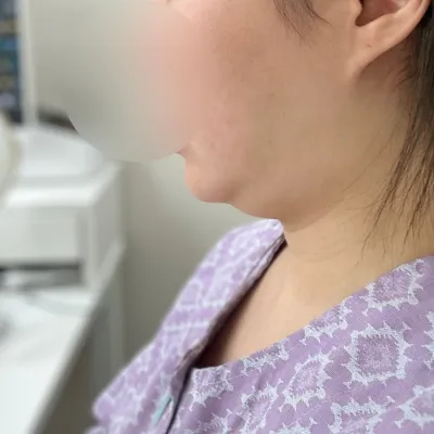 날렵한 옆턱선으로 아주아주 베리굿이에요