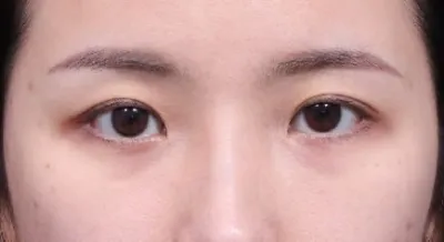 진작에 더 빨리 알아서 했으면 얼마나 좋았을까라는 생각 뿐입니다!