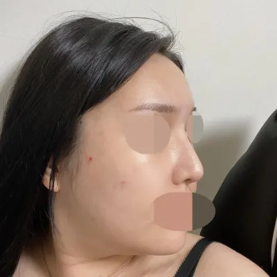 처음 부목 땠을때 라인 그대로 유지 짱짱해요