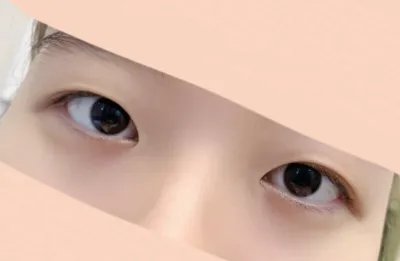 확실히 쌍수한 눈이 세련되 보여서 좋아요