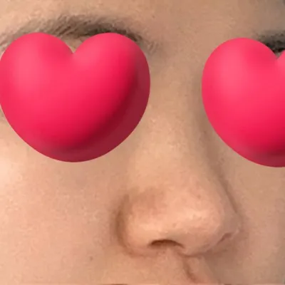 특히 정면개선 잘되서 아주 만족합니다