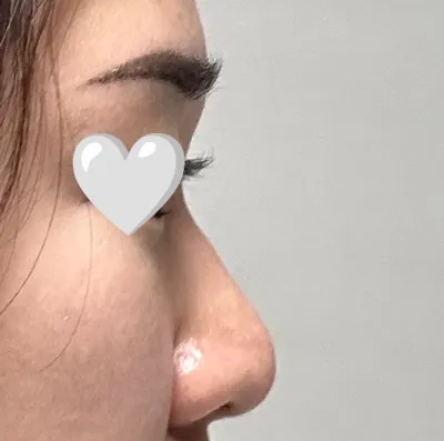 제 얼굴에 어울리는 라인으로 만들어주신거 같아요