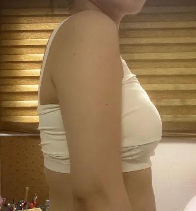 와...진짜 팔 양 옆에 있던 지방들이 그냥 썰렸네요..!너무 만족해요 ㅠㅠㅠ