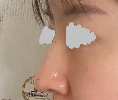 설명도 너무 친절히 잘해주시고,수술도 너무잘되어서 만족스럽습니다!