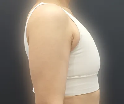 하길 너무 잘했다생각하고 다른부위도 또고민되는곳은 더욕심이난다.