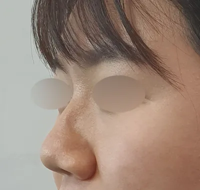 제 두번째 아버지인 김용우 원장님, 남재성 원장님!!! 예쁘게 수술 해주셔서 감사합니다!​♥♥