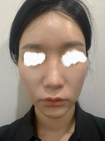 원장님께 긴곡선사각턱 작년에 받고 만족스러워서