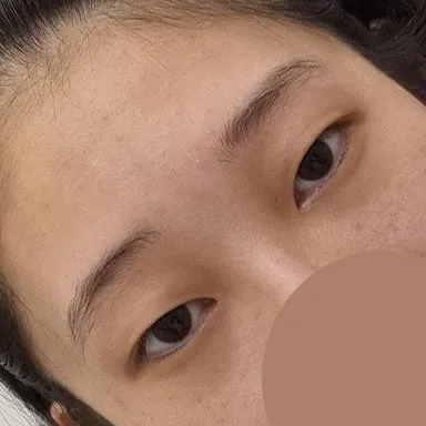 제 눈으로 자리 잡았고 붓기도 다 빠진 상태 인 것 같아요! 화장할때 만족감이 제일 큽니다~