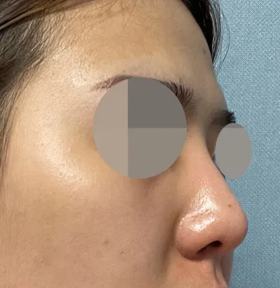 이제 자리는 다 잘잡았고 관리만 잘하면 이대로 쭉 될꺼 같네여 ㅎㅎ