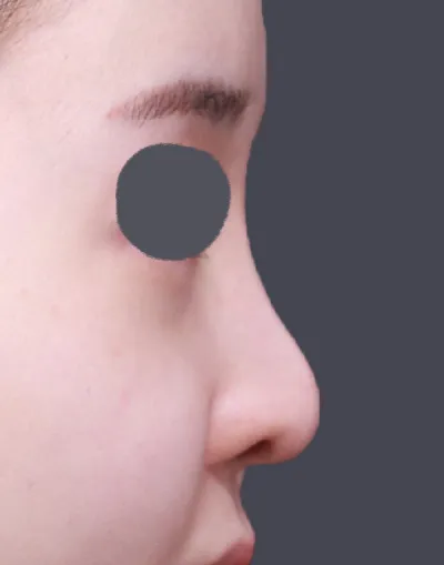 다들 예뻐지세요~~