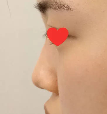 너무 맘에들고 주변에서도 이쁘다고 난리에요