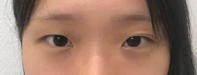 이쁘게 잘되서 너무 만족하면서 살고 있어요!!