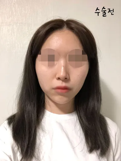제가 광대를 했는지도 잊어버릴 정도 ㅋㅋㅋ