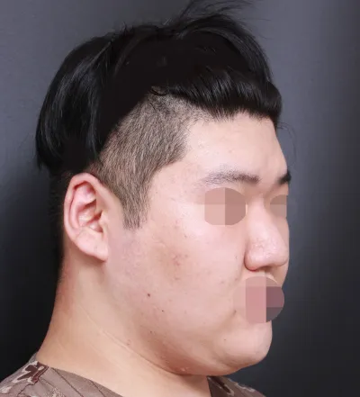 역시 임영민 대표원장님 최고