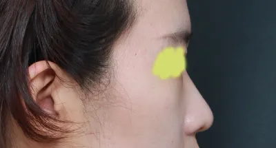 첫코 후기 남겨요~