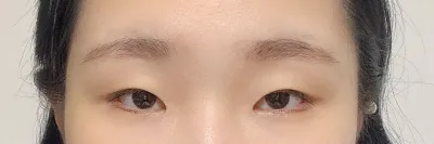 드디어 기다리고 기다리던 쌍수했습니당..