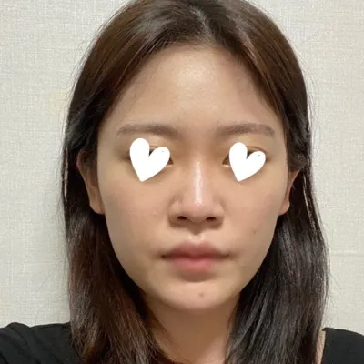 코 수술 하나로 이미지 변신해서 기분좋네요 ❤️