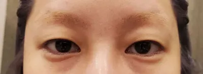 자연유착 한지 이제 한달 조금 지났는데요~