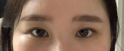 듀얼트임을 하고 완전 만족해요