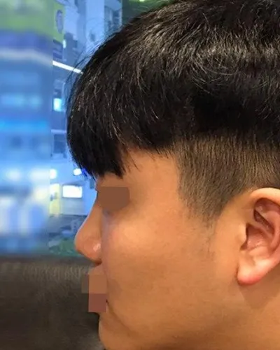 망설이는분들 주저말고 상담이라도 해보세요