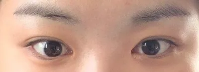 베리굿 쌍수맛집이니까 고민하시는 분들 얼른 방문하세용~!