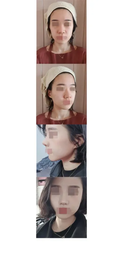 코막혀서 불편한 점 빼고는 아주 좋았어요!