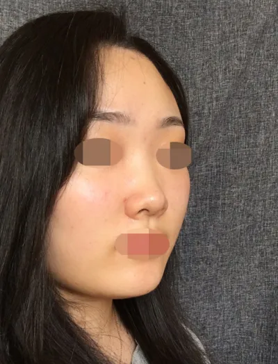 원장님이 정말 객관적으로 보안해야 할 점을 알려주시고 디자인적인 질문을 드렸더니 불가능한 부분도 미리 말씀해 주시고 솔직하게 상담해주셔서 더 좋았어요.