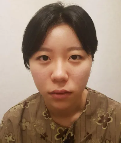 쌍수고민하시는 분들 꼭 하세요!