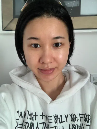 수술한지 벌써 6개월이 지났어요~! 후기 남겨용~