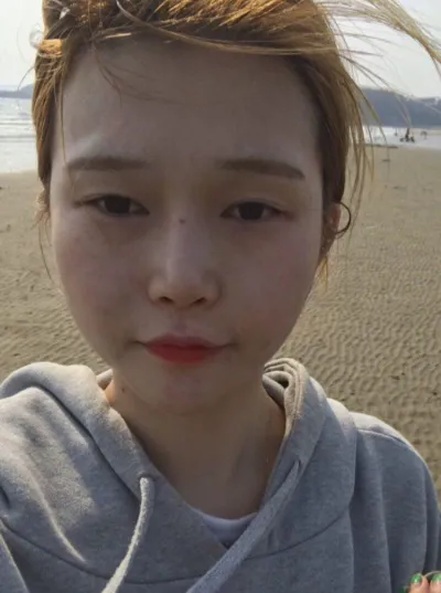 2년전에 베리굿 임영민 원장님께 눈 코 풀페이스 지방이시기 후기남기러 왔습니당