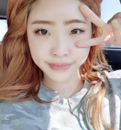 수술한지 3개월 대써요! 붓기도 다 빠진거 같아요