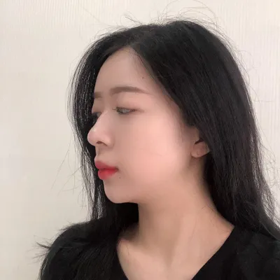 코수술 3개월차 후기 입니다~ㅎㅎ