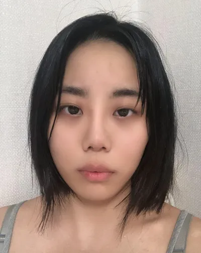 지금은 부기 다 빠지고 제가 너무 원했던 라인으로 자연스럽게 눈이커져서 너무너무 만족중입니다ㅠㅠ
