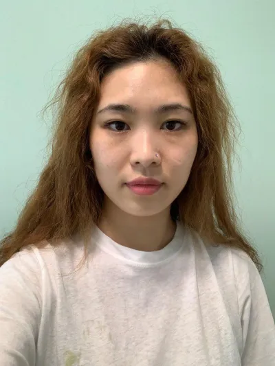 눈 코 사각턱축소 후기 갑니다~~